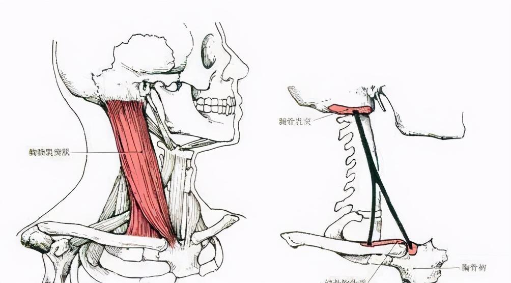 六个月宝宝斜颈图片，了解、识别与帮助