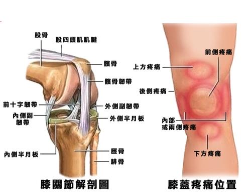 膝关节置换后三个月的疼痛，原因、管理与恢复