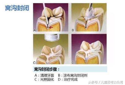 七个月宝宝长牙齿要注意的事项与护理建议