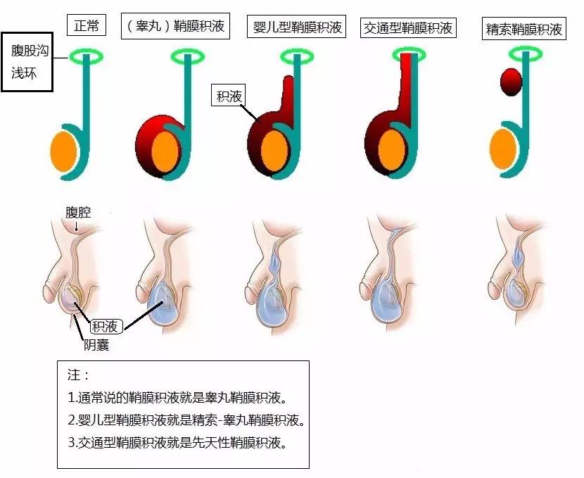 六个月男宝宝生殖器官的发育与护理