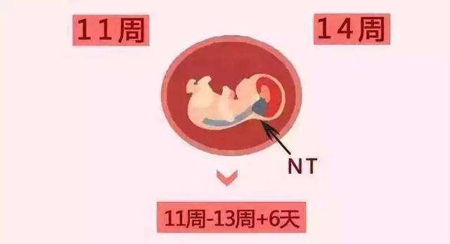 唐氏筛查，最佳时间与重要性